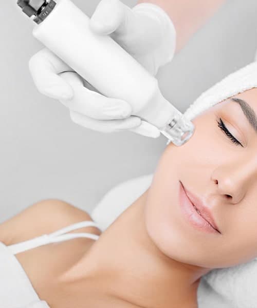 Mesotherapy for Glowing Face